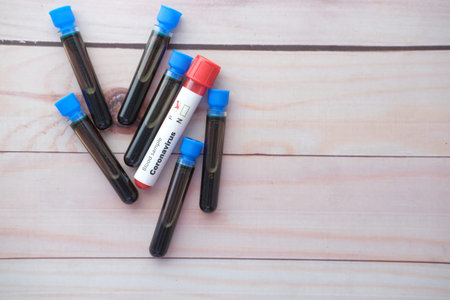 Top view of corona virus blood test tube