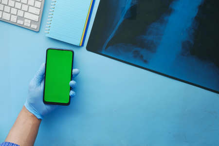 xray photography , smart phone on blue backgroundの写真素材