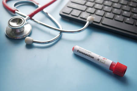 close up of virus blood test tube on blue backgroundの写真素材