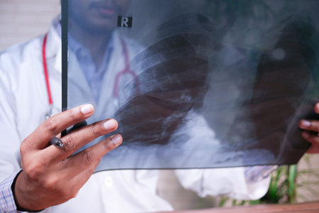 doctor hold analyzing xray photography, closeup