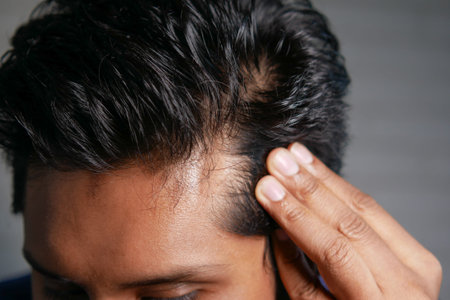 hair loss concept with man checking his hair