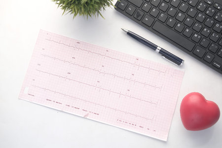 heart shape , keyboard and a cardio diagram on table