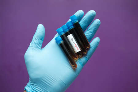 hand hold delta corona virus blood test tubeの写真素材
