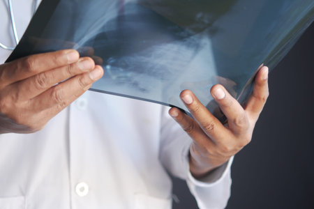doctor hold analyzing xray photography, closeup
