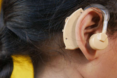 Hearing aid concept, a kid with hearing problems.の写真素材