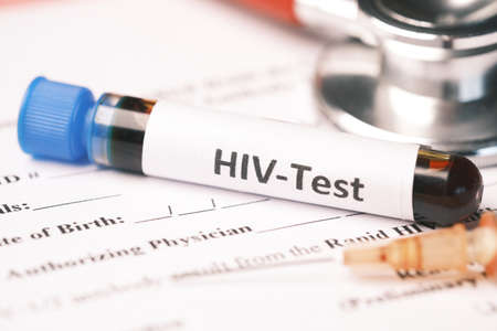 HIV blood test tube and prescription on tableの写真素材