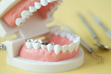 plastic dental teeth model on white backgroundの写真素材