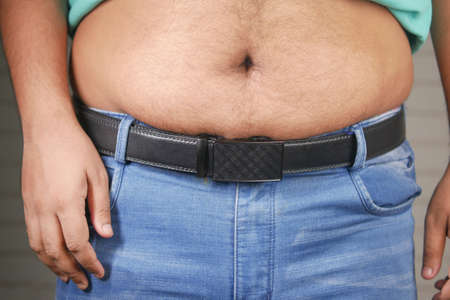 man with excessive belly fat, overweight conceptの写真素材