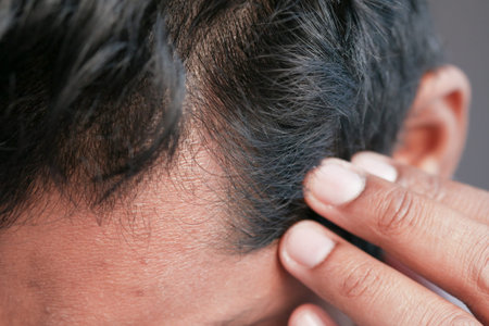 hair loss concept with man checking his hair