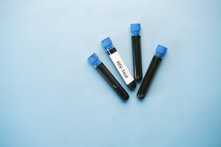HIV blood test tube and prescription on table