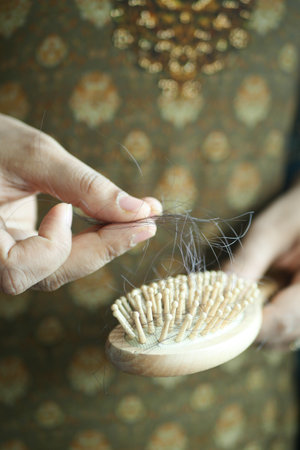 women hold her lost hair close upの写真素材