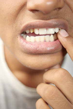 teenage boy with sensitive teeth