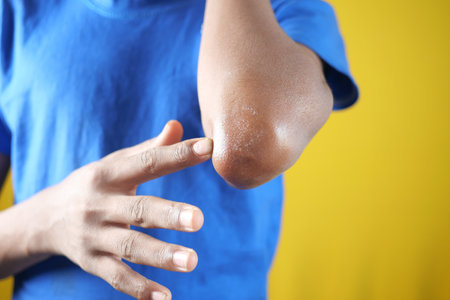men applying petroleum jelly on elbowの写真素材