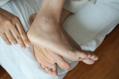 close up of women feet with swellingの写真素材