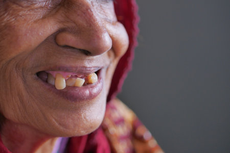 close up of senior womens dental caries and some broken teethの写真素材