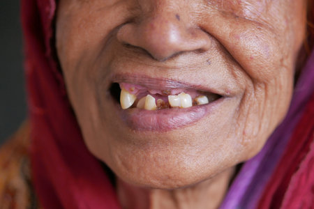 close up of senior womens dental caries and some broken teeth