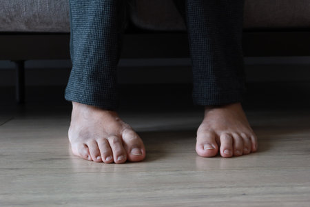 close up of women feet with swellingの写真素材