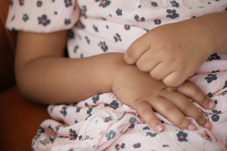 child suffering from itching skin, close up.の写真素材
