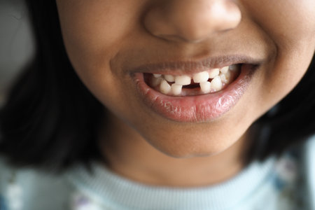 detail shot of child with teeth missingの写真素材