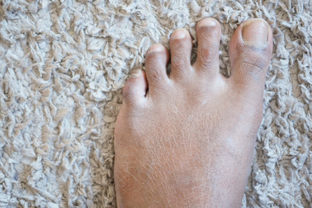 close up of young man dry feet on floor