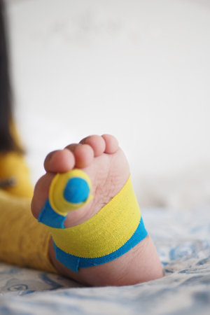 Elastic therapeutic blue tape applied to child foot. Kinesio Taping therapy for injuryの写真素材