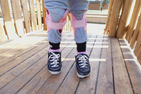A little girl in orthosis shoes crosses a wooden bridge Child cerebral palsy disability.