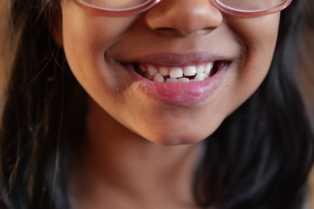 A cheerful child with glasses proudly shows off their beautiful, healthy teeth, embodying joyの写真素材