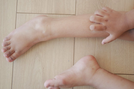 a kid suffering from itching skin on feetの写真素材
