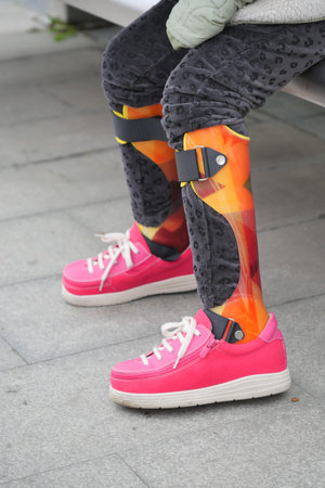 Child sitting on a bench wearing colorful leg braces and pink shoes