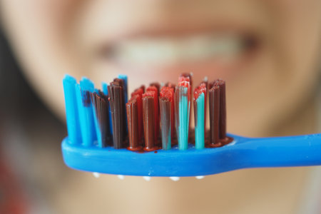 Close-up view of a blue toothbrush with bloodの写真素材