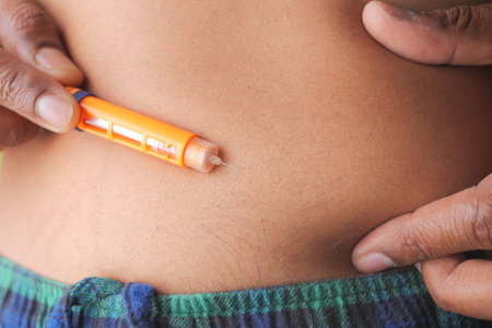 Person inject insulin in his abdomenの写真素材