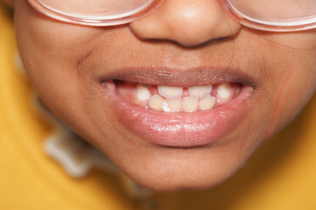 Young child smiles broadly showing missing teethの写真素材