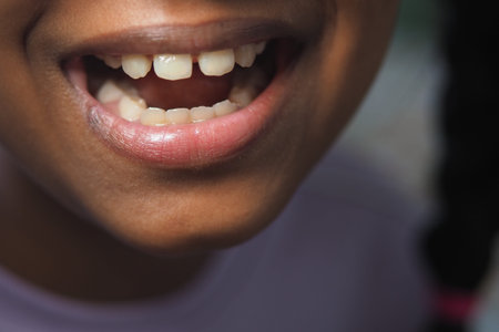 Child smiles brightly showcasing missing teeth during playの写真素材
