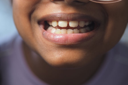 Child smiles widely showing teeth at home