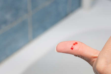 A wounded finger, drops of blood on it.の写真素材