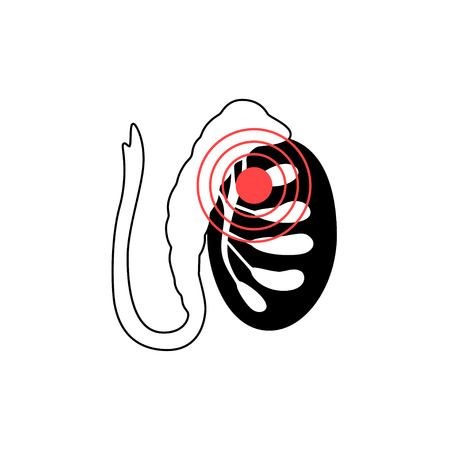Vector isolated illustration of male pain reproductive system anatomy. Testis, scrotum, vessels icon. Man health medical center, hospital, clinic, diagnostic icon. Internal sick organ symbol design.のイラスト素材