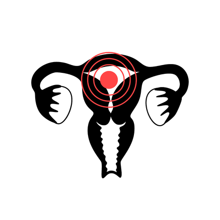 Vector isolated illustration of female pain reproductive system anatomy. Uterus, cervix, ovary, fallopian tube icon. Woman medical center, hospital, clinic, diagnostic icon. Internal organ symbol design.のイラスト素材