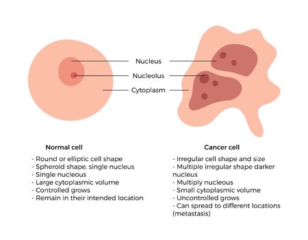 Vector isolated illustration of cell structure: normal and cancer. Medical diagram for poster, educational, science and medical use. Cancer icon or logoのイラスト素材