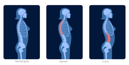 Spine X ray