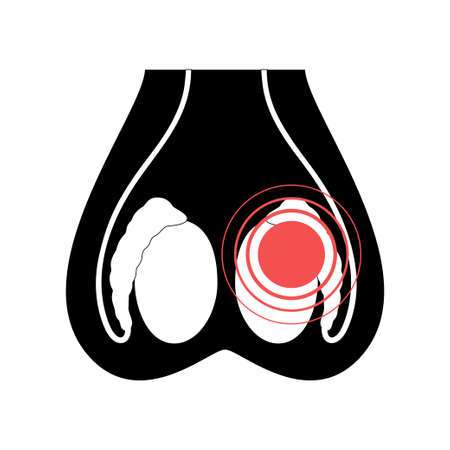 Testis cancer icon and pain in scrotum concept. Tumor in male reproductive system logo. Treatment for man health. Human sexual organ anatomy. Flat vector illustration. Medical poster for clinic.のイラスト素材