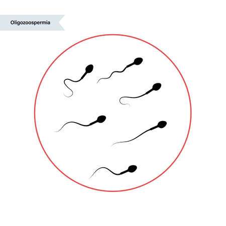 In vitro fertilisation conceptのイラスト素材