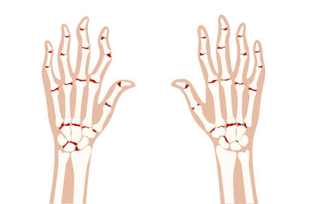 Arthrits x rayのイラスト素材