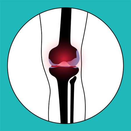 Arthritis in knee jointのイラスト素材