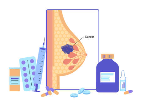 Breast disease conceptのイラスト素材