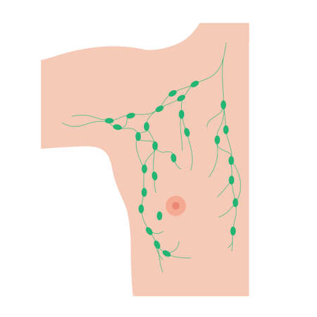 Breast disease conceptのイラスト素材