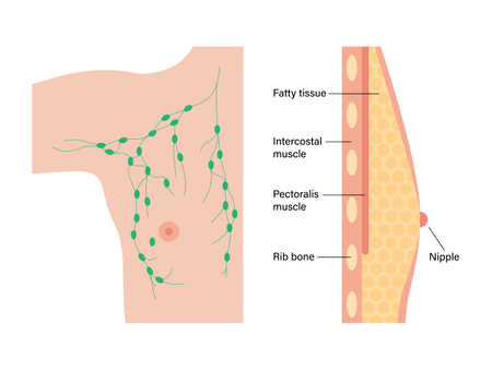 Breast disease conceptのイラスト素材