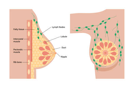 Breast disease conceptのイラスト素材