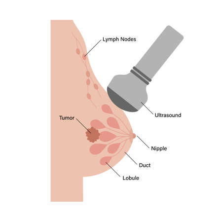 Breast disease conceptのイラスト素材