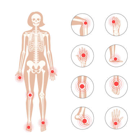 Normal bones conceptのイラスト素材