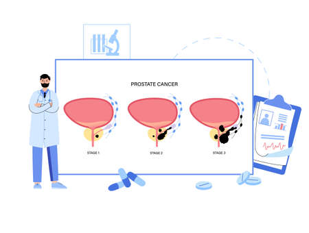 Man Reproducive System Problemsのイラスト素材